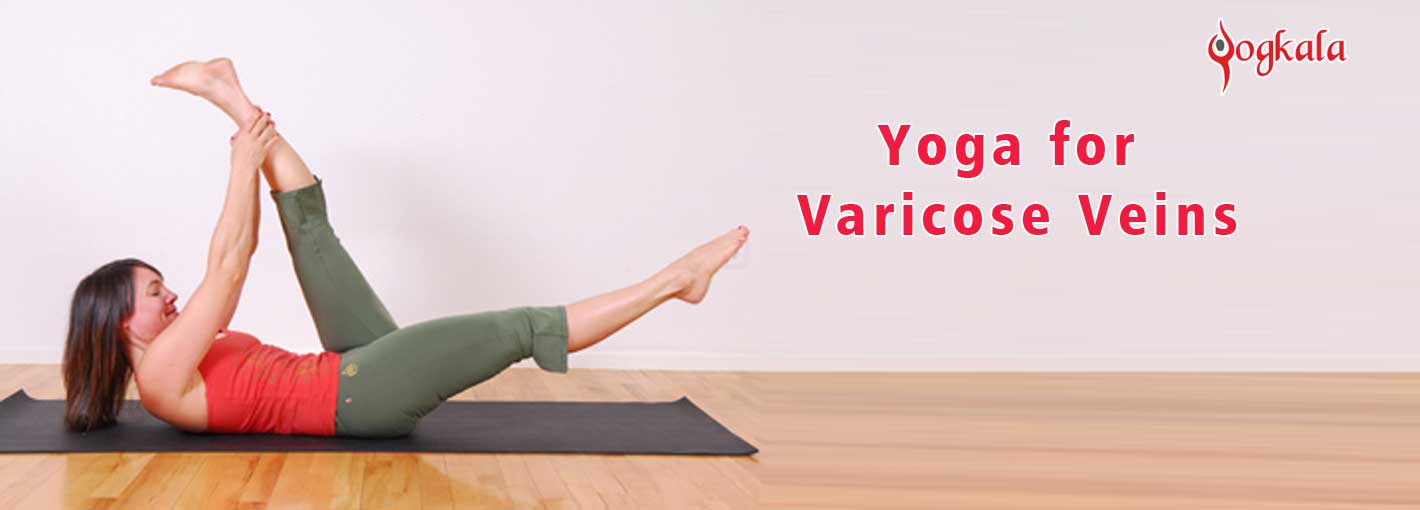 Yoga for Varicose Veins